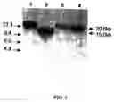 Fig. 09 - VMP-like sequences of pathogenic species and strains