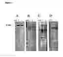 Fig. 04 - Neisserial vaccine compositions comprising a combination of antigens