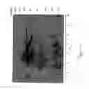Fig. 02 - Use of aspartic proteases in cosmetics and therapeutics