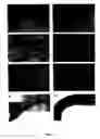 Fig. 03 - Structure of modulating intraocular pressure on glaucoma