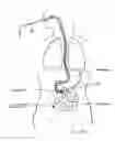 Fig. 09 - Devices and methods for treating the gastrointestinal system