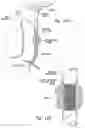 Fig. 13 - Anti-angiogenic compositions and methods of use