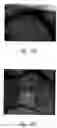 Fig. 31 - Anti-angiogenic compositions and methods of use