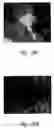 Fig. 33 - Anti-angiogenic compositions and methods of use