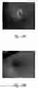 Fig. 34 - Anti-angiogenic compositions and methods of use