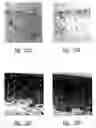 Fig. 37 - Anti-angiogenic compositions and methods of use