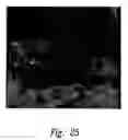 Fig. 40 - Anti-angiogenic compositions and methods of use