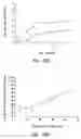 Fig. 45 - Anti-angiogenic compositions and methods of use