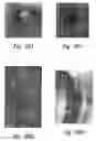 Fig. 77 - Anti-angiogenic compositions and methods of use