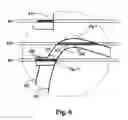 Fig. 06 - Apparatus and method for knurling material