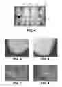 Fig. 03 - Overcoat for dental devices