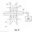 Fig. 35 - Method and device for improving oral health