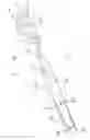Fig. 02 - Dental implement and method for tooth surface inspection