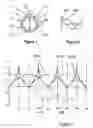 Fig. 02 - Surgical device, in particular a dental device, comprising an instrument and a servo-control module