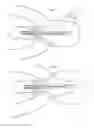 Fig. 12 - Dental implant with an integral structure comprising a stump completely or partially realized in advance