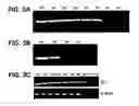 Fig. 04 - Detection and identification of enteroviruses by semi-nested amplification of the enterovirus VP1 protein