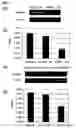 Fig. 07 - Genes and polypeptides relating to myeloid leukemia