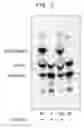 Fig. 03 - Method of screening for compounds that inhibit the enzymatic activity of GWT1 gene product