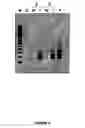 Fig. 05 - Method for hybridisation of immobilized genomic dna