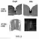 Fig. 03 - Lrp4/corin dopamine-producing neuron proliferation precursor cell marker