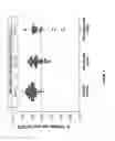 Fig. 02 - Method of evaluating a subject for risk or predisposition of reduced renal function over time