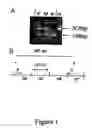 Fig. 02 - Methods for detecting nemaline myopathy
