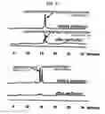 Fig. 07 - Diagnostic method for Celiac Sprue