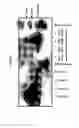 Fig. 03 - Immunoprecipitation-based assay for predicting in vivo efficacy of beta-amyloid antibodies