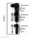 Fig. 04 - Immunoprecipitation-based assay for predicting in vivo efficacy of beta-amyloid antibodies