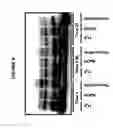 Fig. 05 - Immunoprecipitation-based assay for predicting in vivo efficacy of beta-amyloid antibodies