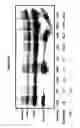 Fig. 07 - Immunoprecipitation-based assay for predicting in vivo efficacy of beta-amyloid antibodies