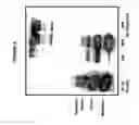 Fig. 09 - Immunoprecipitation-based assay for predicting in vivo efficacy of beta-amyloid antibodies