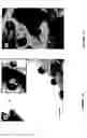 Fig. 02 - Proteins involved in cytoadhesion of plasmodium falciparum ring-stage-infected erythrocytes, antibodies which bind to the proteins, and methods for detecting infection, stage of infection and vaccines for protecting against infection