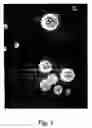 Fig. 02 - Cultures of human CNS neural stem cells