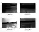 Fig. 02 - Fibrin cell supports and method of use thereof
