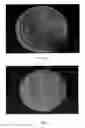 Fig. 15 - Optical system including nanostructures for biological or chemical sensing