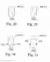 Fig. 13 - Enhanced stress metal spring contactor