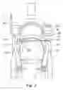 Fig. 04 - Bicycle cable