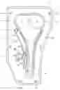 Fig. 01 - Timing transmission having enhanced timing chain removal and replacement feature, and method