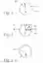 Fig. 02 - Tension-reducing random sprocket