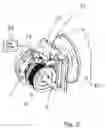 Fig. 04 - Differential for an electrically powered driving axle