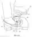 Fig. 04 - Twisting treadmill
