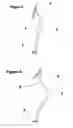 Fig. 04 - Human lower limb performance enhancement outfit