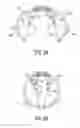 Fig. 07 - Exercise apparatus