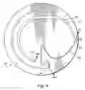 Fig. 04 - Apparatus for separation of a fluid with a separation channel having a mixer component