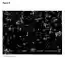 Fig. 04 - Polyporous material having nanoparticle and their preparation thereof