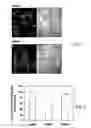 Fig. 03 - Treatment of hyperproliferative disease
