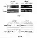 Fig. 05 - Treatment of hyperproliferative disease
