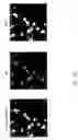Fig. 23 - Methods and compositions for ameliorating or inhibiting decline in memory or intelligence or improving same