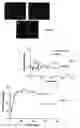 Fig. 02 - Method and kit for regulation of microvascular tone